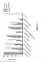 Fig. 06 - Liposomal formulation of nonglycosidic ceramides and uses thereof