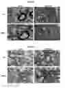 Fig. 07 - Methods of treating or preventing fibrotic lung diseases