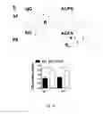Fig. 03 - METHODS AND COMPOUNDS FOR THE TREATMENT OF BONE LOSS AND/OR PAIN