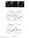 Fig. 12 - METHODS AND COMPOUNDS FOR THE TREATMENT OF BONE LOSS AND/OR PAIN