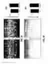 Fig. 07 - Methods For Treating Nicotinic Acetylcholine Receptor Associated Diseases