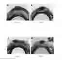 Fig. 08 - Compositions and methods relating to treatment of infection