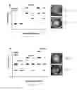 Fig. 16 - Compositions and methods relating to treatment of infection