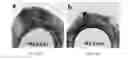 Fig. 19 - Compositions and methods relating to treatment of infection