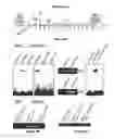 Fig. 10 - STAT5a and its functional tumor suppressor analogs for treatment of malignancies expressing NPM/ALK and other oncogenic kinases