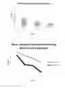 Fig. 03 - Methods for treating age-related organ or tissue dysfunction through heterochronic transbiosis using nonviable pluripotent stem cells