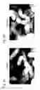 Fig. 07 - Agent for inducing interferon production containing lactic acid bacteria