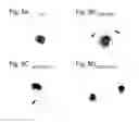 Fig. 16 - Agent for inducing interferon production containing lactic acid bacteria