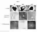 Fig. 02 - COMPOSITION FOR PREVENTING AND TREATING NON-ALCOHOLIC FATTY LIVER DISEASES