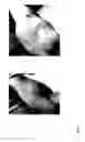 Fig. 06 - METHOD FOR DIAGNOSING AND TREATING CANCER USING NAIVE STATE STEM CELL SPECIFIC GENES