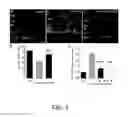 Fig. 04 - METHODS OF USING GAP JUNCTIONS AS THERAPEUTIC TARGETS FOR THE TREATMENT OF DEGENERATIVE DISORDERS OF THE RETINA