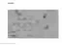 Fig. 03 - Composition and method for treating nucleic acid-related eye disease