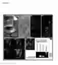 Fig. 13 - Composition and method for treating nucleic acid-related eye disease
