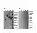 Fig. 04 - Multi-component-multistage malaria vaccines