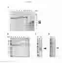 Fig. 07 - Multi-component-multistage malaria vaccines