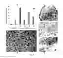 Fig. 04 - COMPOSITIONS AND METHODS USING STEM CELLS IN CUTANEOUS WOUND HEALING
