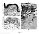 Fig. 08 - COMPOSITIONS AND METHODS USING STEM CELLS IN CUTANEOUS WOUND HEALING