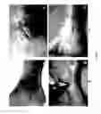 Fig. 09 - COMPOSITIONS AND METHODS USING STEM CELLS IN CUTANEOUS WOUND HEALING