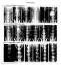 Fig. 06 - Nanofiber paste for growth factor delivery and bone regeneration