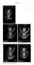Fig. 08 - Nanofiber paste for growth factor delivery and bone regeneration
