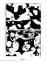Fig. 05 - Moldable bone graft compositions