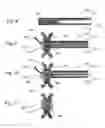 Fig. 11 - Methods, systems and devices for treating hypertension