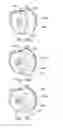 Fig. 14 - Flow regulating inhaler device