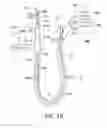Fig. 03 - SUCTION CATHETER WITH DISTAL SUCTION MODULATION
