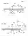Fig. 09 - SUCTION CATHETER WITH DISTAL SUCTION MODULATION
