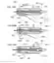 Fig. 19 - SUCTION CATHETER WITH DISTAL SUCTION MODULATION