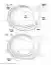 Fig. 03 - Expandable cardiac shunt