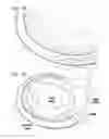 Fig. 08 - Expandable cardiac shunt