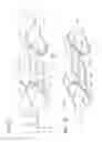 Fig. 19 - Expandable cardiac shunt