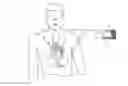 Fig. 01 - Dual sensor electrodes for providing enhanced resuscitation feedback