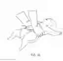 Fig. 20 - Dual sensor electrodes for providing enhanced resuscitation feedback