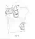 Fig. 23 - Dual sensor electrodes for providing enhanced resuscitation feedback
