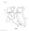 Fig. 02 - Fixation sleeve equipped leadless pulse generator