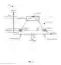 Fig. 04 - MRI-safe implantable lead assembly
