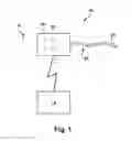 Fig. 02 - System and method for treating obstructive sleep apnea