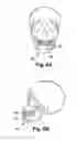 Fig. 06 - System and method for treating obstructive sleep apnea