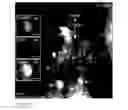 Fig. 13 - Implantable, highly collimated light-emitters for biological applications