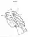 Fig. 03 - INSERT MOLDING PROCESS