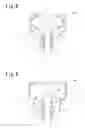Fig. 08 - Bladder-fixing unit