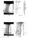 Fig. 06 - Seals for stretchable films