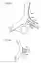 Fig. 11 - Torsion beam suspension