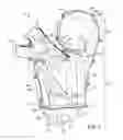 Fig. 08 - TUB-LESS REAR HVAC
