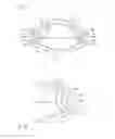 Fig. 17 - Airbag and method for operating a vehicle occupant protection system