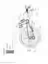 Fig. 11 - Electric bicycle transmission systems, methods, and devices