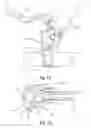 Fig. 09 - Handlebar fastener for a switchgear unit