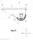 Fig. 13 - Rope hoist